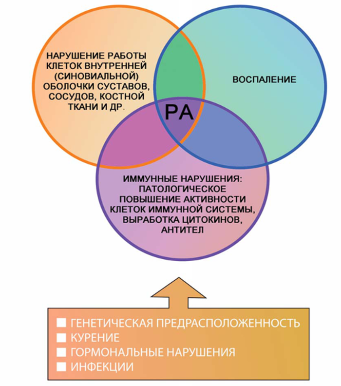 Возникновение и развитие ревматоидного артрита